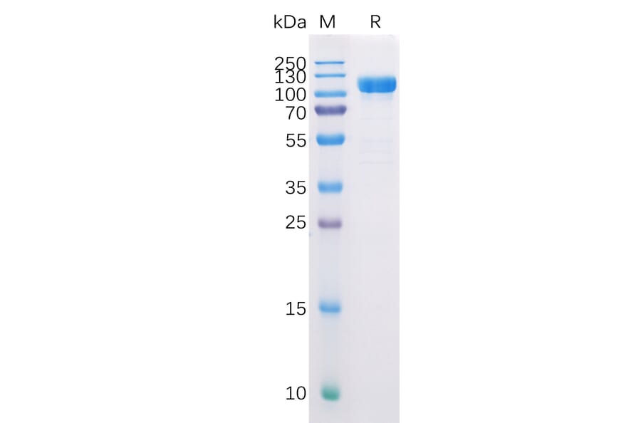 SDS-PAGE - Recombinant Human CD10 Protein (Fc Tag) (A318226) - Antibodies.com