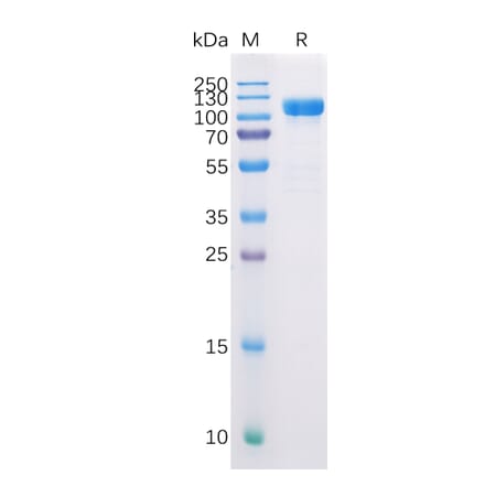 SDS-PAGE - Recombinant Human CD10 Protein (Fc Tag) (A318226) - Antibodies.com