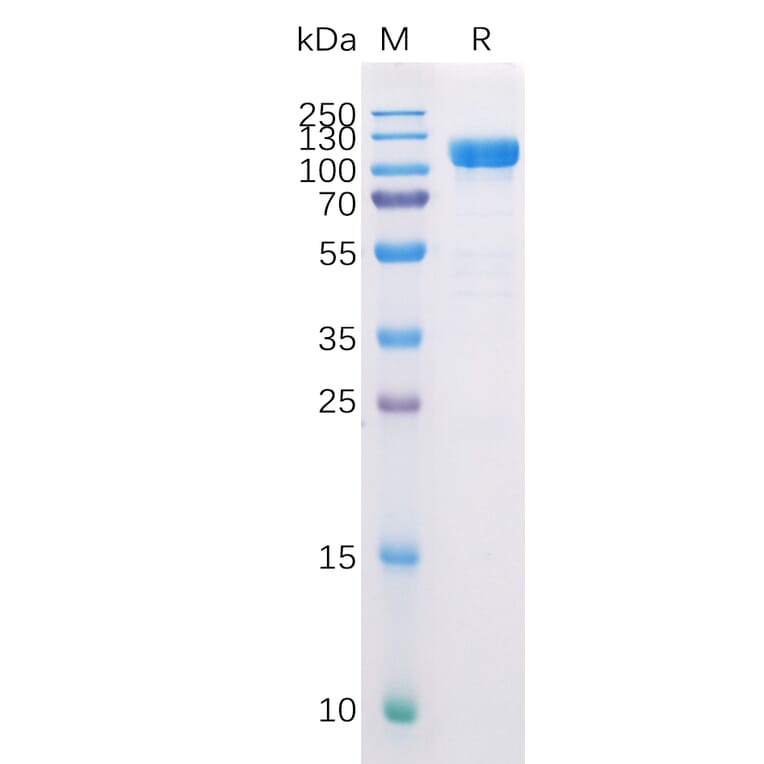 SDS-PAGE - Recombinant Human CD10 Protein (Fc Tag) (A318226) - Antibodies.com