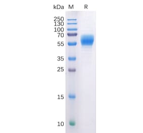 SDS-PAGE - Recombinant Human Cannabinoid Receptor I Protein (Fc Tag) (A318227) - Antibodies.com