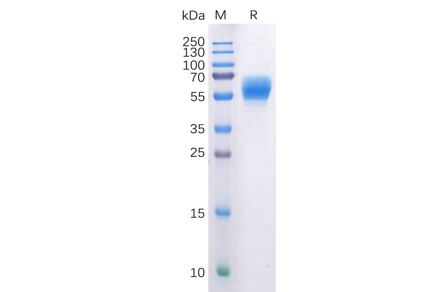 SDS-PAGE - Recombinant Human Cannabinoid Receptor I Protein (Fc Tag) (A318227) - Antibodies.com