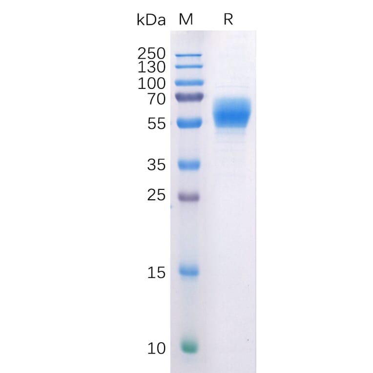 SDS-PAGE - Recombinant Human Cannabinoid Receptor I Protein (Fc Tag) (A318227) - Antibodies.com