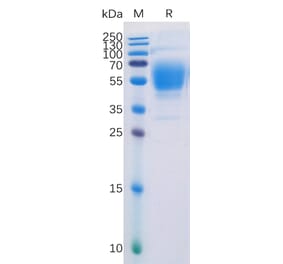 SDS-PAGE - Recombinant Human Cannabinoid Receptor I Protein (Fc Tag) (A318228) - Antibodies.com