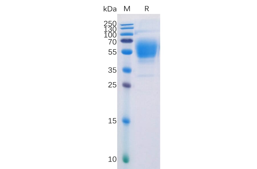 SDS-PAGE - Recombinant Human Cannabinoid Receptor I Protein (Fc Tag) (A318228) - Antibodies.com