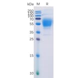 SDS-PAGE - Recombinant Human Cannabinoid Receptor I Protein (Fc Tag) (A318228) - Antibodies.com