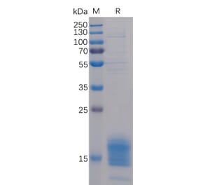 SDS-PAGE - Recombinant Human TIGIT Protein (6×His Tag) (A318229) - Antibodies.com