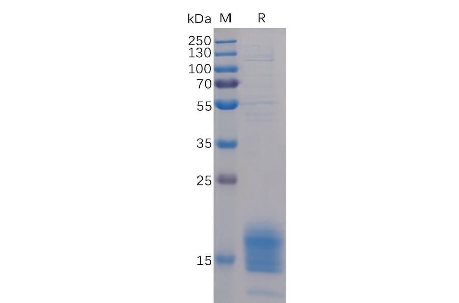 SDS-PAGE - Recombinant Human TIGIT Protein (6×His Tag) (A318229) - Antibodies.com