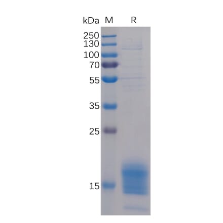 SDS-PAGE - Recombinant Human TIGIT Protein (6×His Tag) (A318229) - Antibodies.com