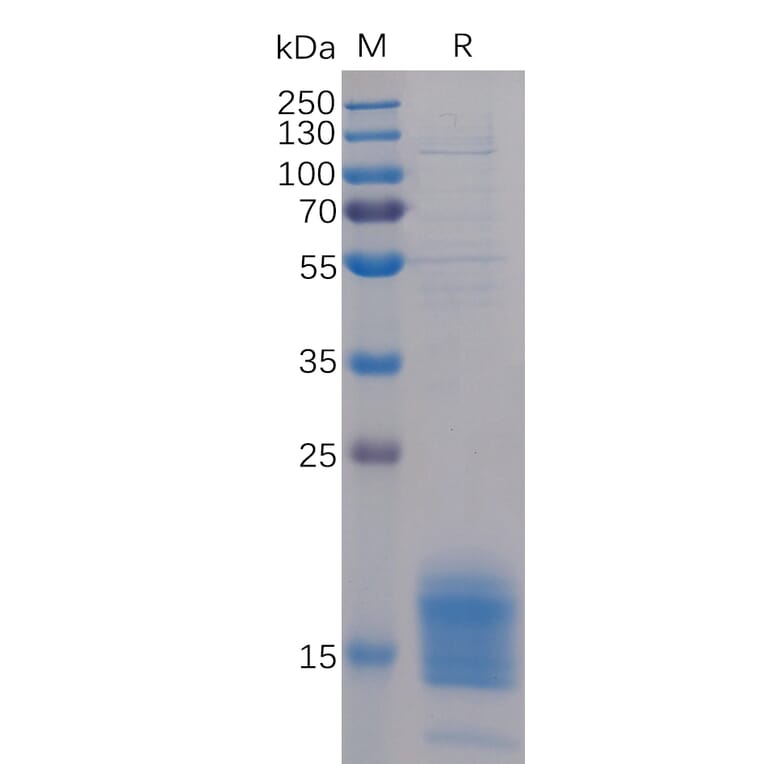 SDS-PAGE - Recombinant Human TIGIT Protein (6×His Tag) (A318229) - Antibodies.com