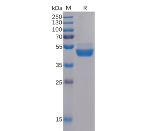 SDS-PAGE - Recombinant Human TIGIT Protein (Fc Tag) (A318230) - Antibodies.com