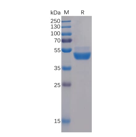 SDS-PAGE - Recombinant Human TIGIT Protein (Fc Tag) (A318230) - Antibodies.com