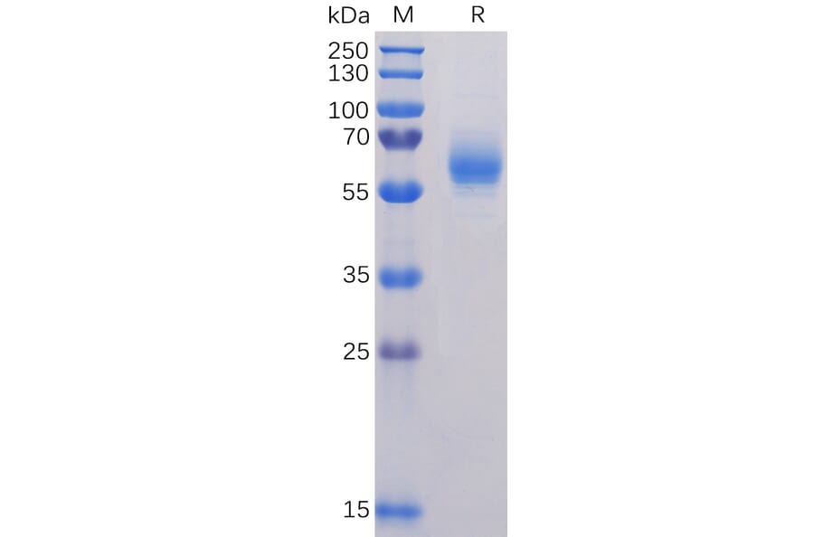 SDS-PAGE - Recombinant SARS-CoV-2 Nucleocapsid Protein (6×His Tag) (A318231) - Antibodies.com