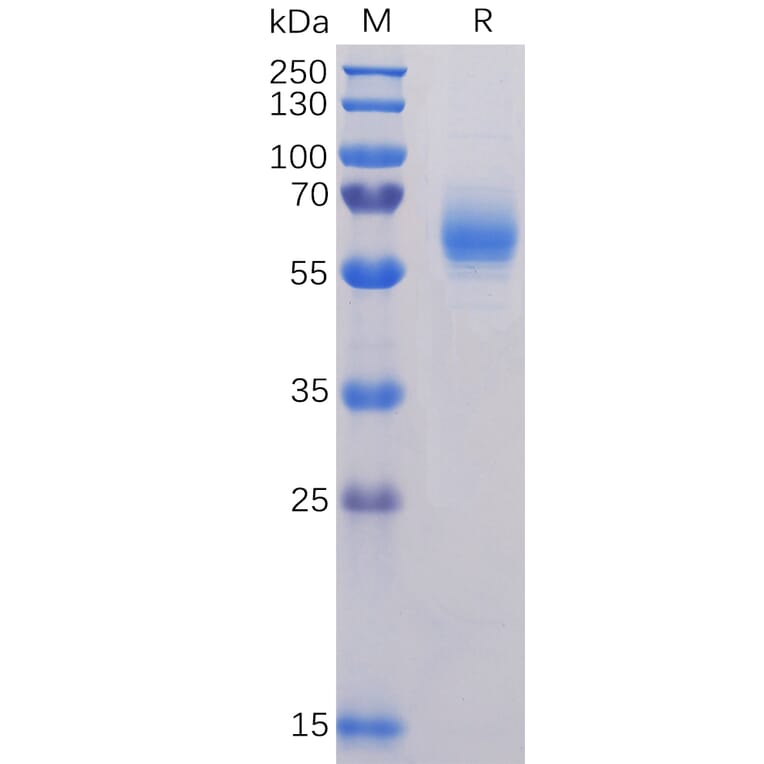 SDS-PAGE - Recombinant SARS-CoV-2 Nucleocapsid Protein (6×His Tag) (A318231) - Antibodies.com