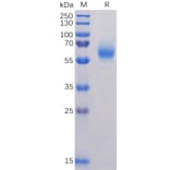 SDS-PAGE - Recombinant SARS-CoV-2 Nucleocapsid Protein (6×His Tag) (A318231) - Antibodies.com