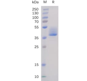 SDS-PAGE - Recombinant Human BAFF-R Protein (Fc Tag) (A318232) - Antibodies.com