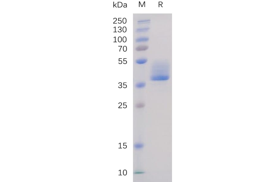 SDS-PAGE - Recombinant Human BAFF-R Protein (Fc Tag) (A318232) - Antibodies.com