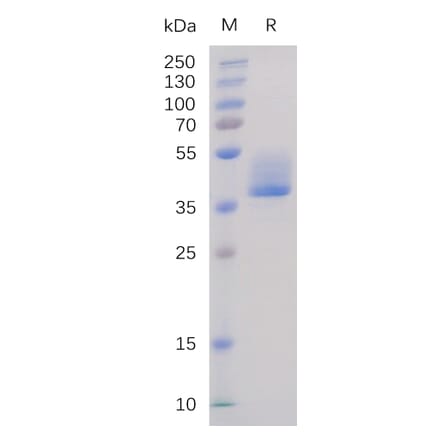 SDS-PAGE - Recombinant Human BAFF-R Protein (Fc Tag) (A318232) - Antibodies.com