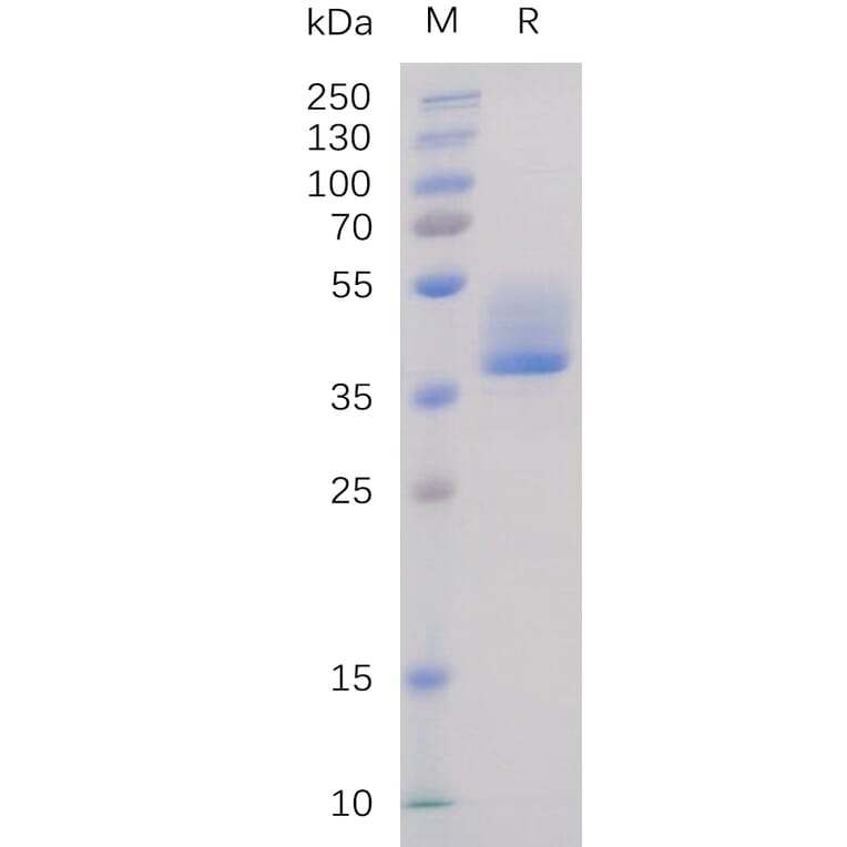 SDS-PAGE - Recombinant Human BAFF-R Protein (Fc Tag) (A318232) - Antibodies.com