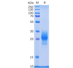 SDS-PAGE - Recombinant Human CD137 Protein (6×His Tag) (A318233) - Antibodies.com