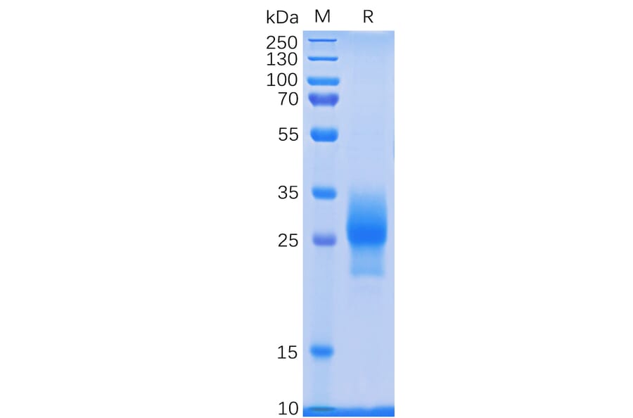 SDS-PAGE - Recombinant Human CD137 Protein (6×His Tag) (A318233) - Antibodies.com