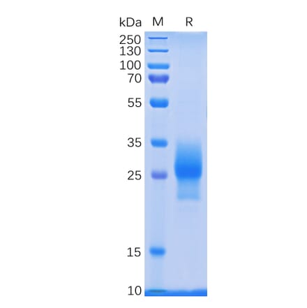 SDS-PAGE - Recombinant Human CD137 Protein (6×His Tag) (A318233) - Antibodies.com