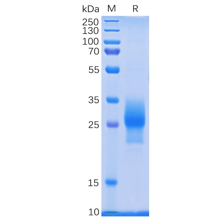 SDS-PAGE - Recombinant Human CD137 Protein (6×His Tag) (A318233) - Antibodies.com