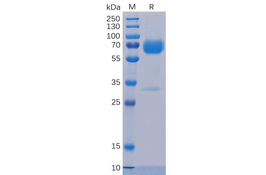 SDS-PAGE - Recombinant Human TROP2 Protein (Fc Chimera 6xHis Tag) (A318234) - Antibodies.com