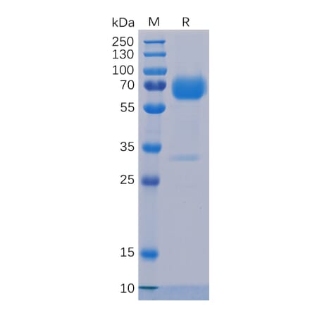 SDS-PAGE - Recombinant Human TROP2 Protein (Fc Chimera 6xHis Tag) (A318234) - Antibodies.com
