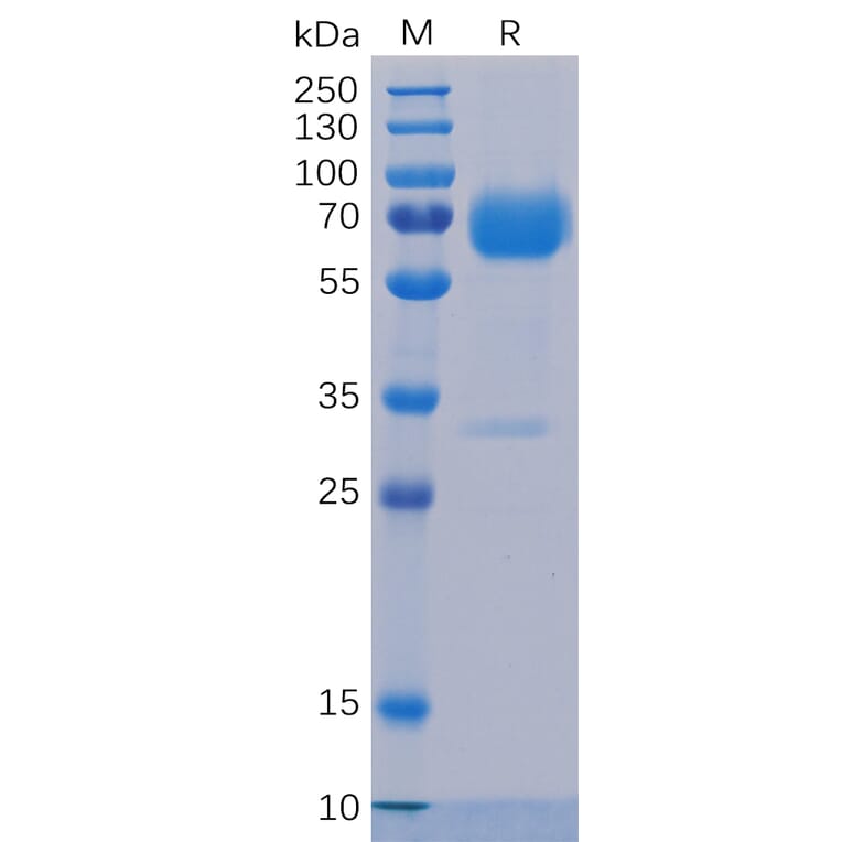SDS-PAGE - Recombinant Human TROP2 Protein (Fc Chimera 6xHis Tag) (A318234) - Antibodies.com