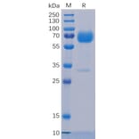 SDS-PAGE - Recombinant Human TROP2 Protein (Fc Chimera 6xHis Tag) (A318234) - Antibodies.com