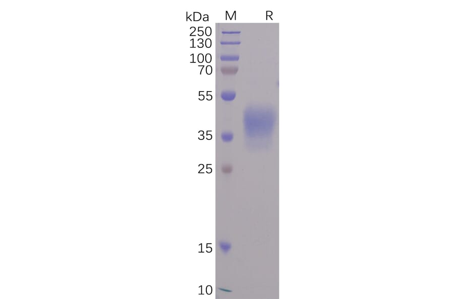 SDS-PAGE - Recombinant SARS-CoV-2 Spike Glycoprotein-Membrane Protein Fusion Protein (6×His Tag) (A318236) - Antibodies.com