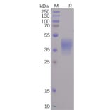 SDS-PAGE - Recombinant SARS-CoV-2 Spike Glycoprotein-Membrane Protein Fusion Protein (6×His Tag) (A318236) - Antibodies.com