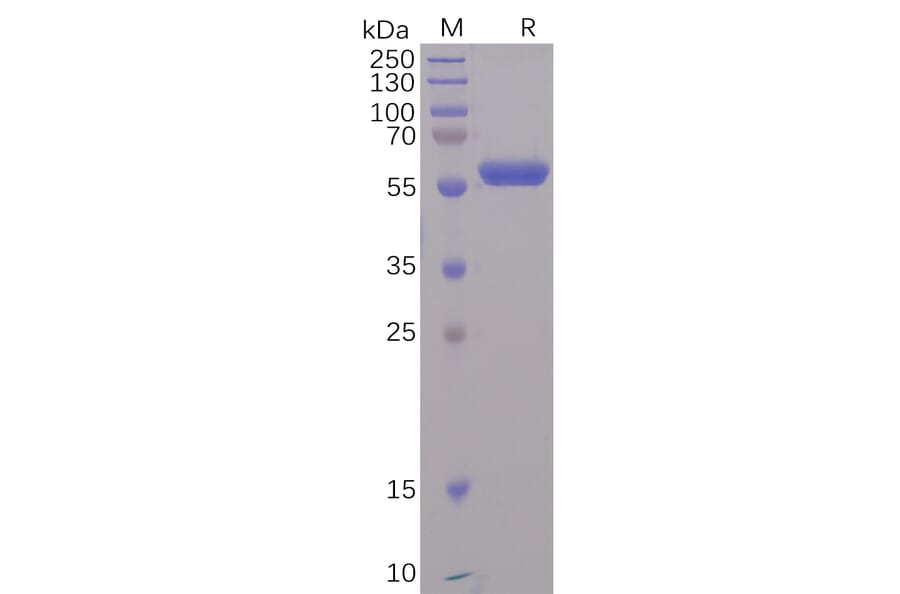 SDS-PAGE - Recombinant SARS-CoV-2 Spike Glycoprotein RBD Protein (Fc Tag) (A318237) - Antibodies.com