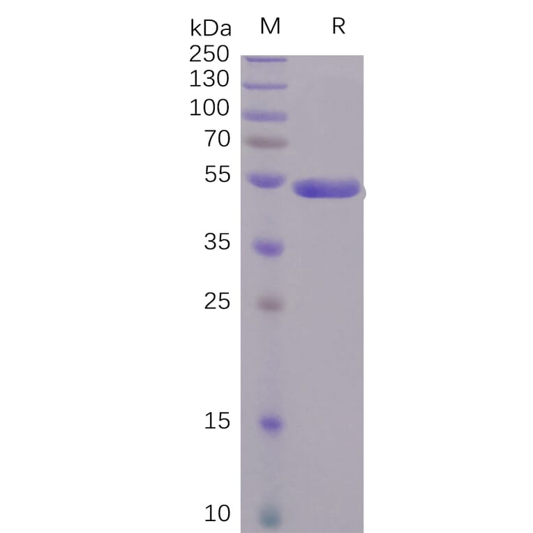 SDS-PAGE - Recombinant SARS-CoV-2 Spike Glycoprotein S1 CTD Protein (Fc Tag) (A318238) - Antibodies.com