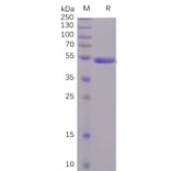 SDS-PAGE - Recombinant SARS-CoV-2 Spike Glycoprotein S1 CTD Protein (Fc Tag) (A318238) - Antibodies.com