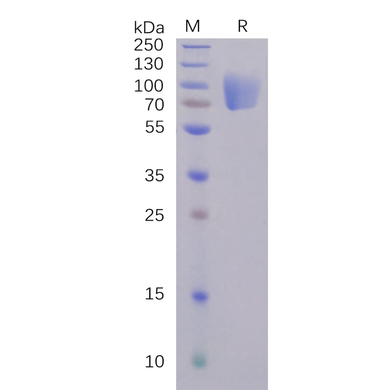 SDS-PAGE - Recombinant SARS-CoV-2 Spike Glycoprotein S1 NTD Protein (Fc Tag) (A318240) - Antibodies.com