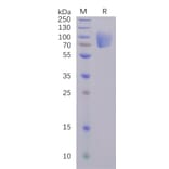 SDS-PAGE - Recombinant SARS-CoV-2 Spike Glycoprotein S1 NTD Protein (Fc Tag) (A318240) - Antibodies.com