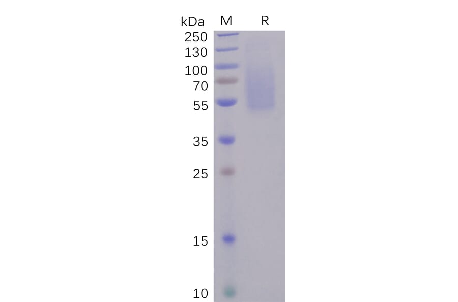 SDS-PAGE - Recombinant SARS-CoV-2 Spike Glycoprotein S1 NTD Protein (6×His Tag) (A318241) - Antibodies.com