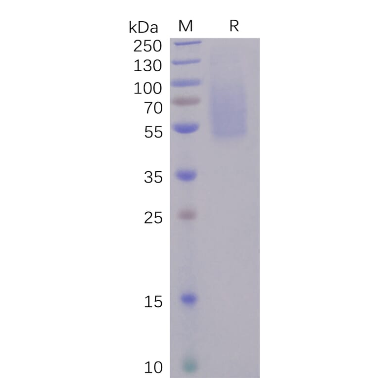 SDS-PAGE - Recombinant SARS-CoV-2 Spike Glycoprotein S1 NTD Protein (6×His Tag) (A318241) - Antibodies.com