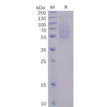 SDS-PAGE - Recombinant SARS-CoV-2 Spike Glycoprotein S1 NTD Protein (6×His Tag) (A318241) - Antibodies.com