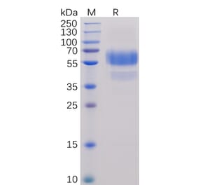 SDS-PAGE - Recombinant Human CD70 Protein (Fc Chimera 6xHis Tag) (A318244) - Antibodies.com