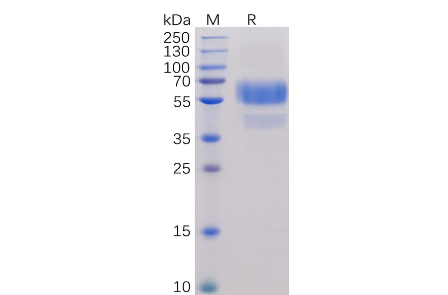 SDS-PAGE - Recombinant Human CD70 Protein (Fc Chimera 6xHis Tag) (A318244) - Antibodies.com