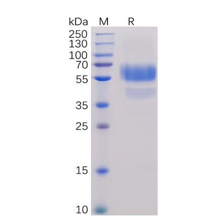 SDS-PAGE - Recombinant Human CD70 Protein (Fc Chimera 6xHis Tag) (A318244) - Antibodies.com