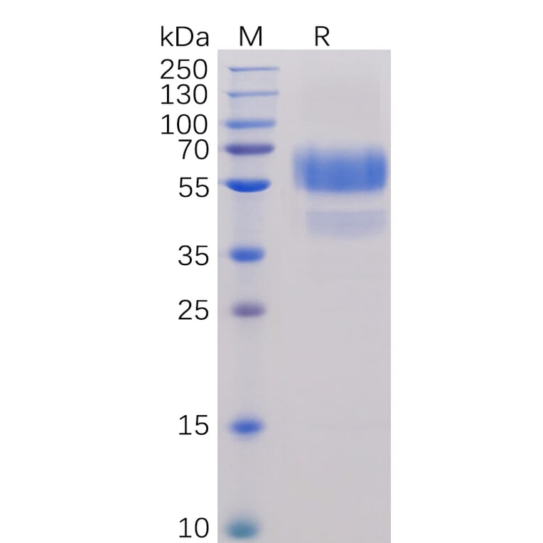SDS-PAGE - Recombinant Human CD70 Protein (Fc Chimera 6xHis Tag) (A318244) - Antibodies.com