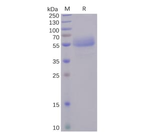 SDS-PAGE - Recombinant Human ICOS Protein (Fc Tag) (A318246) - Antibodies.com