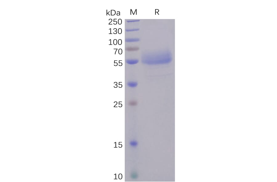 SDS-PAGE - Recombinant Human ICOS Protein (Fc Tag) (A318246) - Antibodies.com