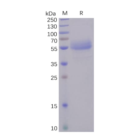 SDS-PAGE - Recombinant Human ICOS Protein (Fc Tag) (A318246) - Antibodies.com