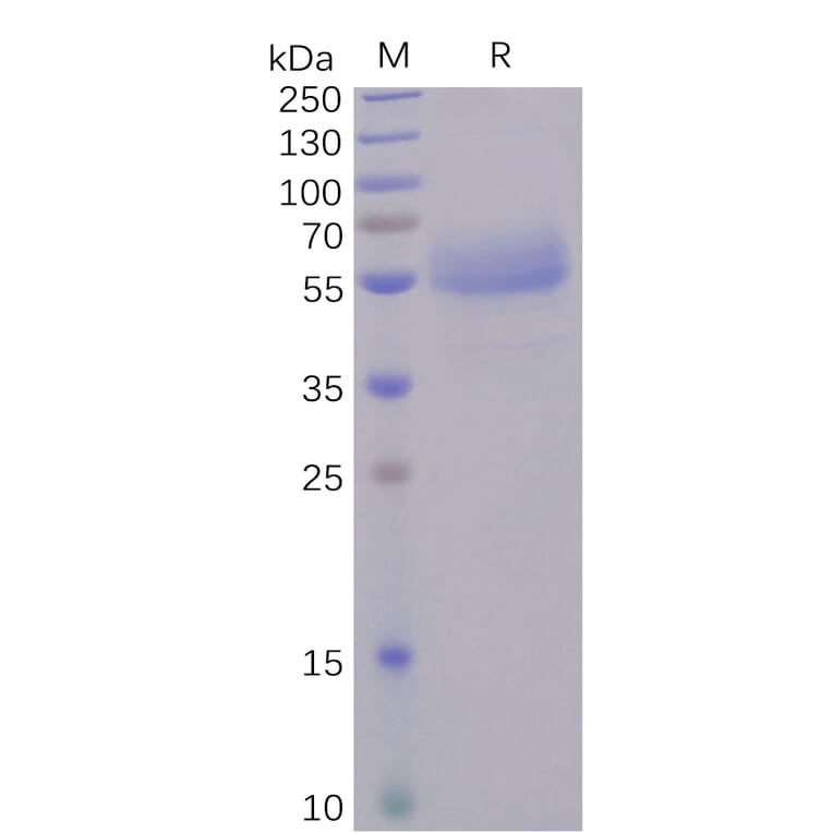 SDS-PAGE - Recombinant Human ICOS Protein (Fc Tag) (A318246) - Antibodies.com