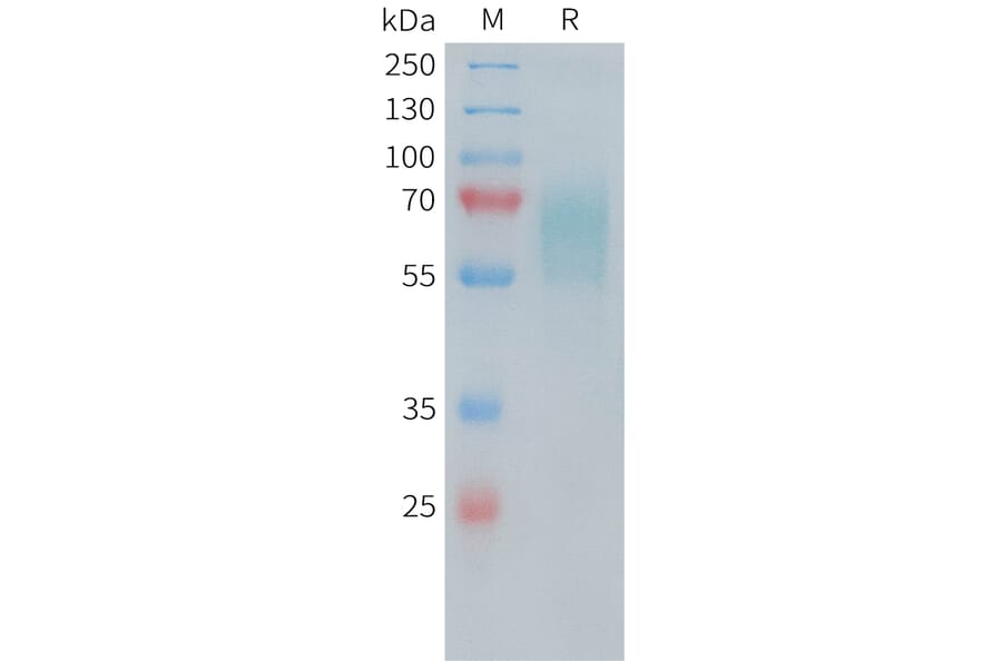 SDS-PAGE - Recombinant Human CD30 Protein (6×His Tag) (A318247) - Antibodies.com