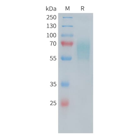 SDS-PAGE - Recombinant Human CD30 Protein (6×His Tag) (A318247) - Antibodies.com
